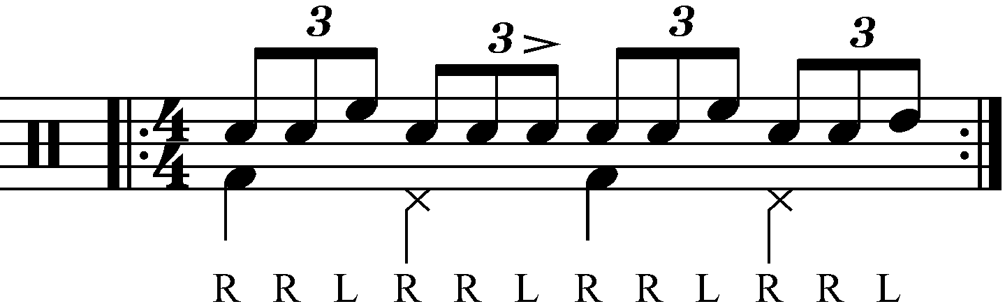 Reverse triplet with moving singles